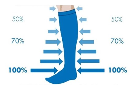 Compressione graduata